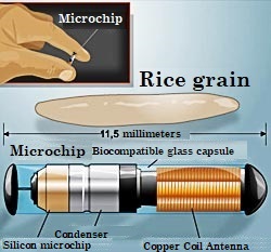 Microchip under the skin